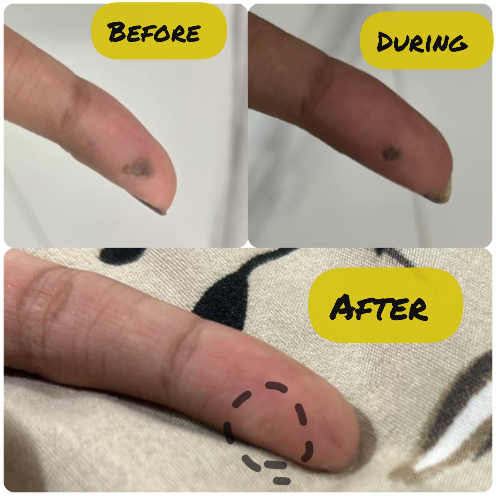 Patient result 1