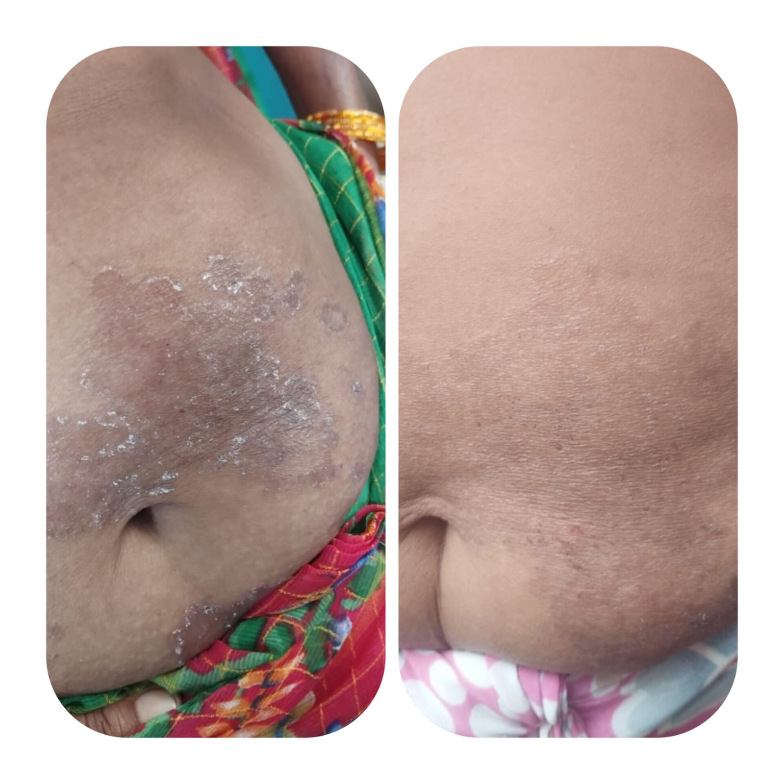 Patient result 2