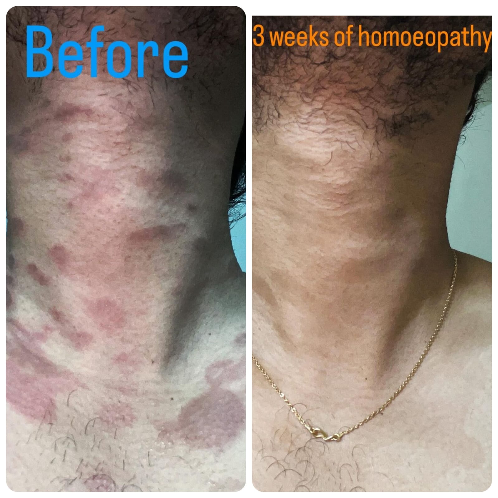 Patient result 3
