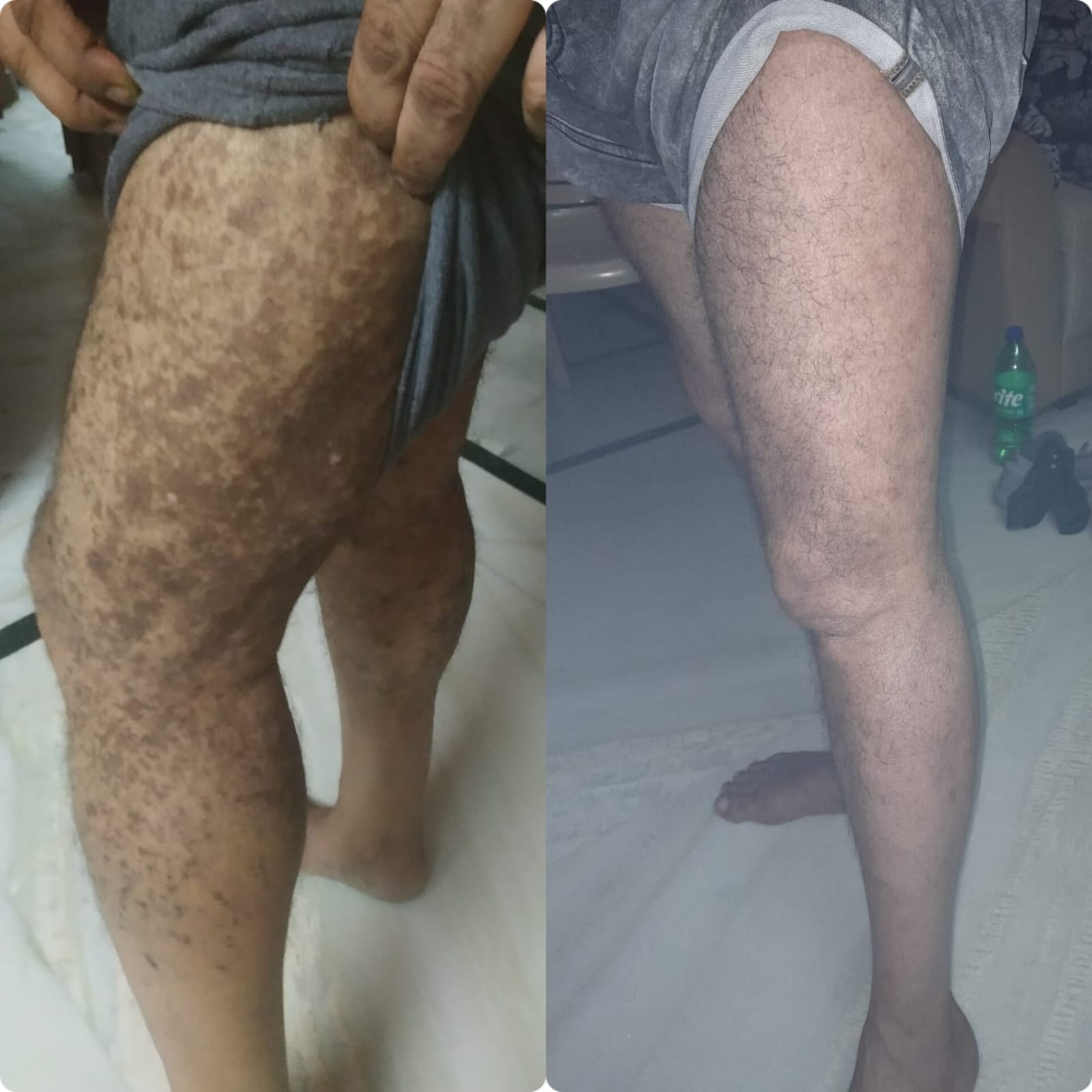 Patient result 4