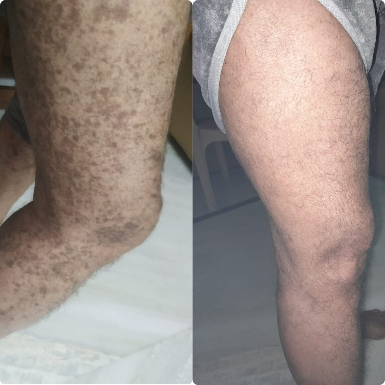 Patient result 5