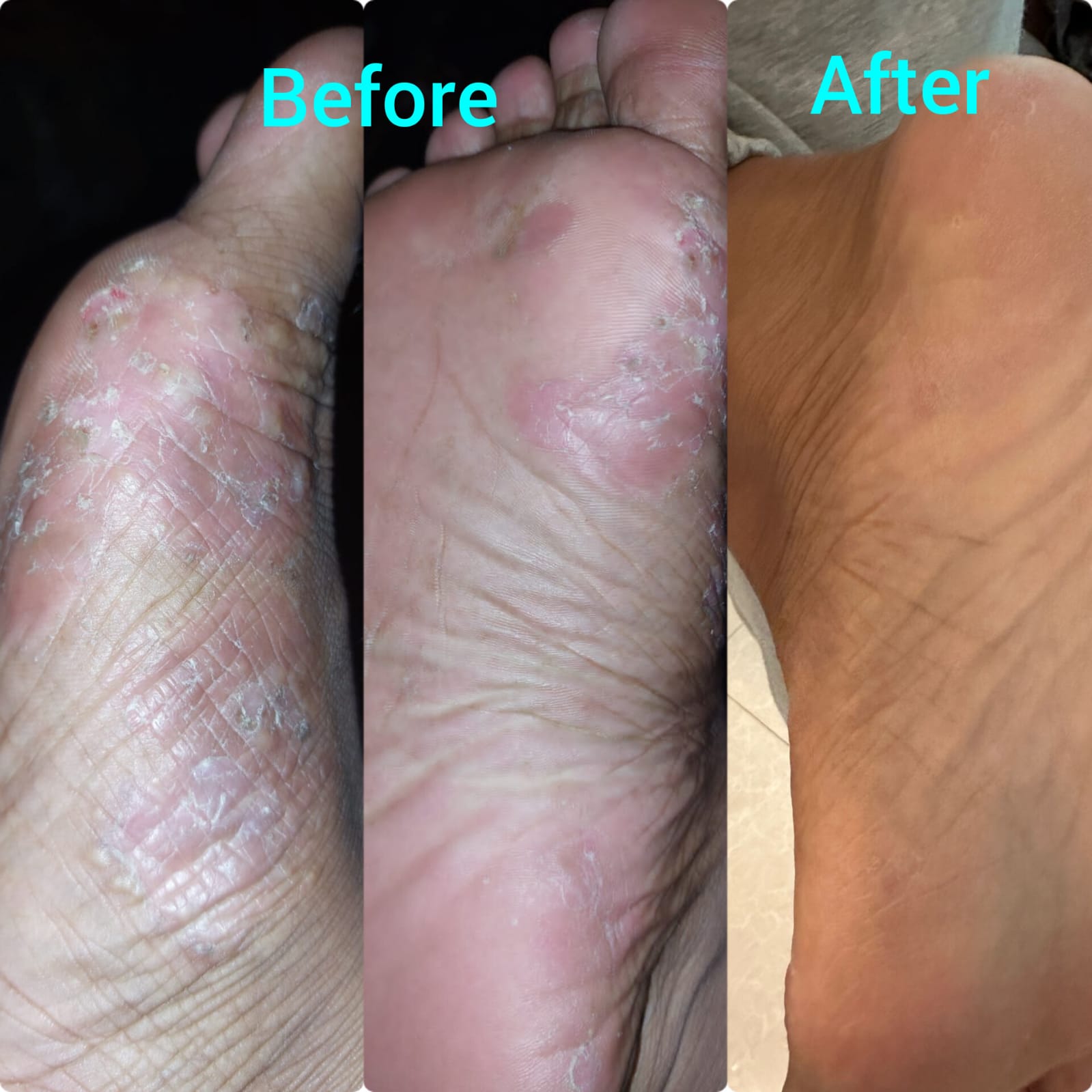 Patient result 6